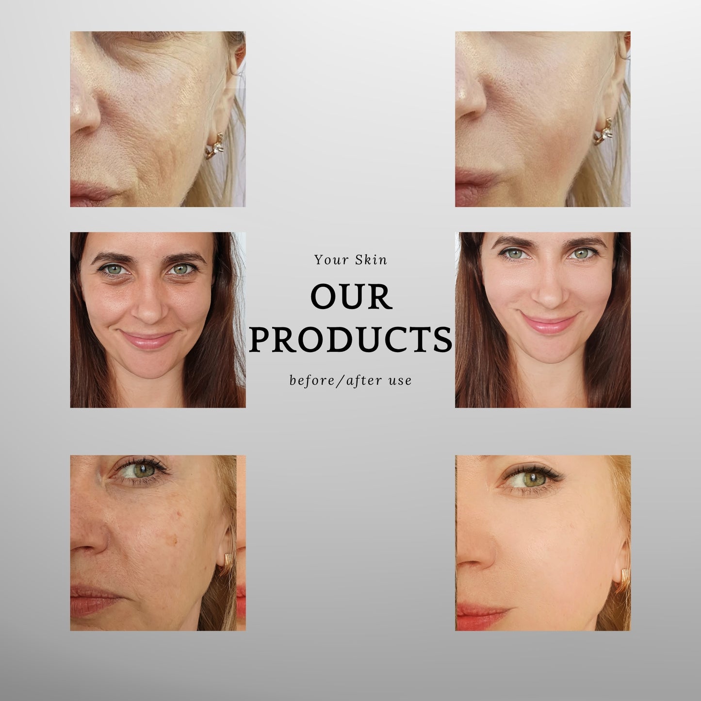 ANLAN 9-in-1 RF Facial Device with 18K Gold Head