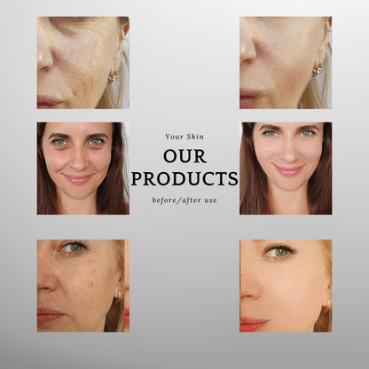 ANLAN 9-in-1 RF Facial Device with 18K Gold Head