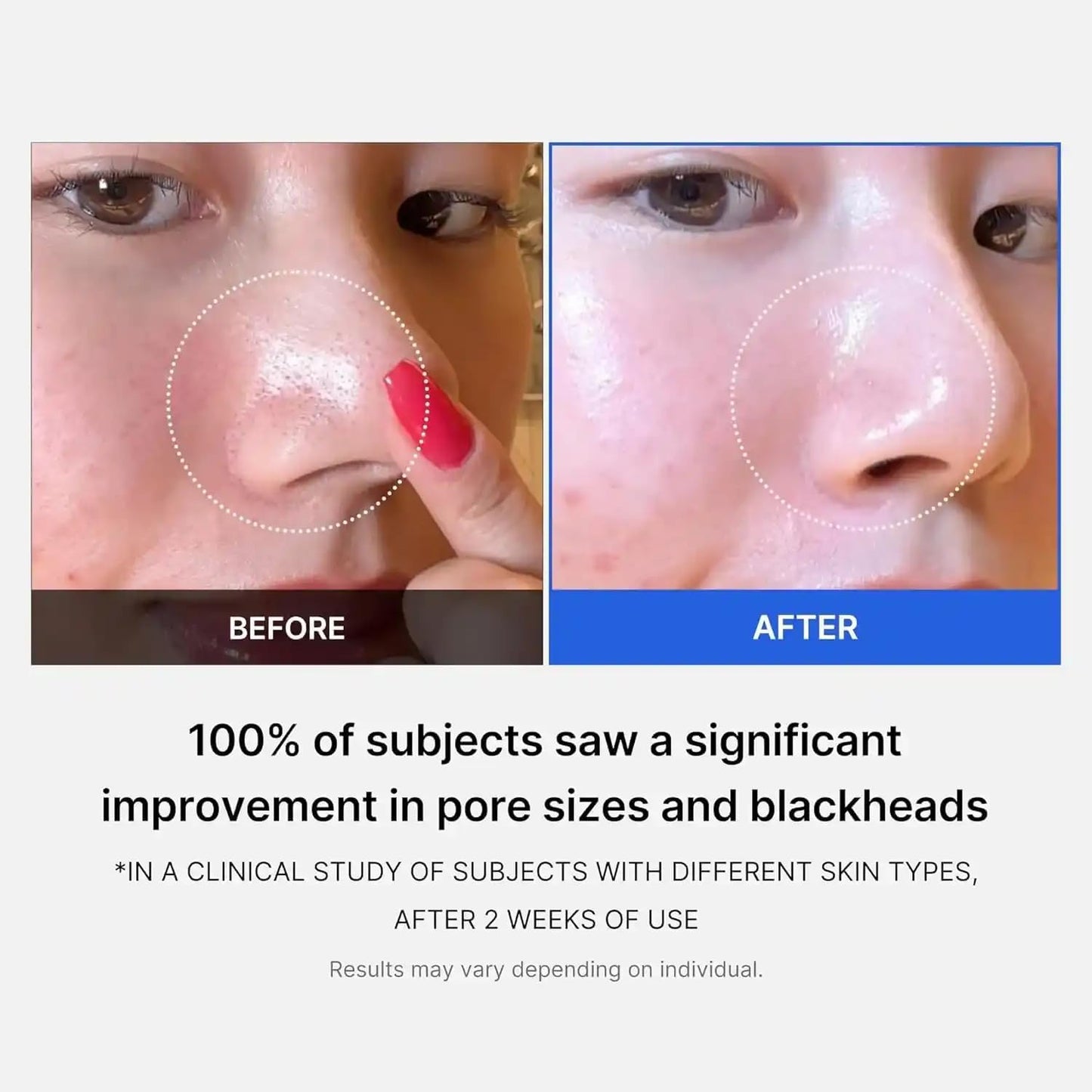 Zero Pore Pad 2.0 [70pcs]