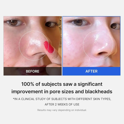Zero Pore Pad 2.0 [70pcs]