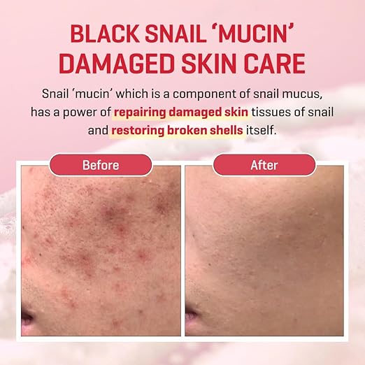 Snail Truecica Miracle Repair Cream [ 60g]