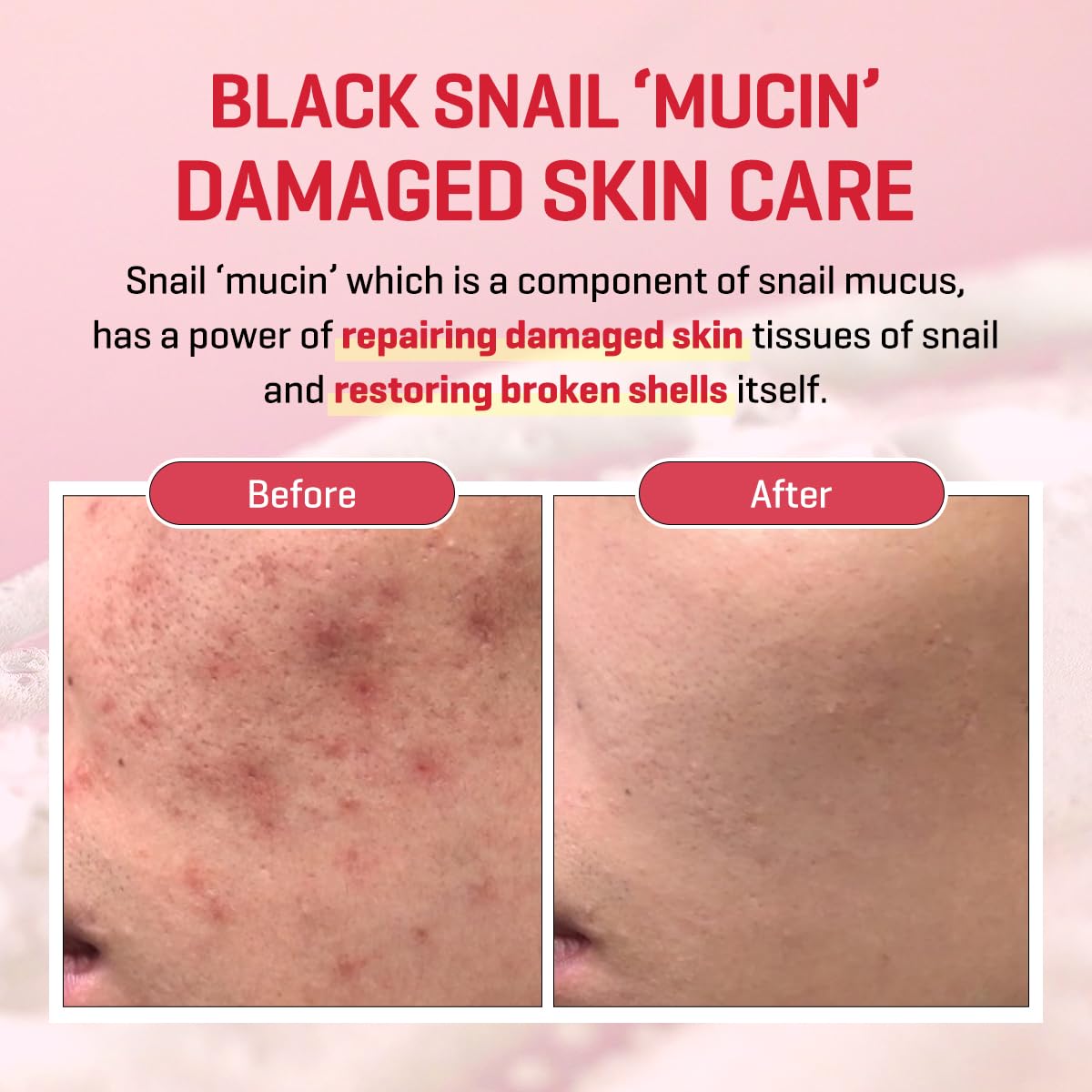Snail Truecica Miracle Repair Low ph Gel Cleanser [100ml]