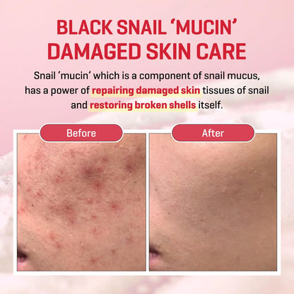 Snail Truecica Miracle Repair Low ph Gel Cleanser [100ml]