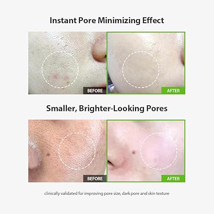 Green Tomato Pore Lifting Ampoule+ [30ml]