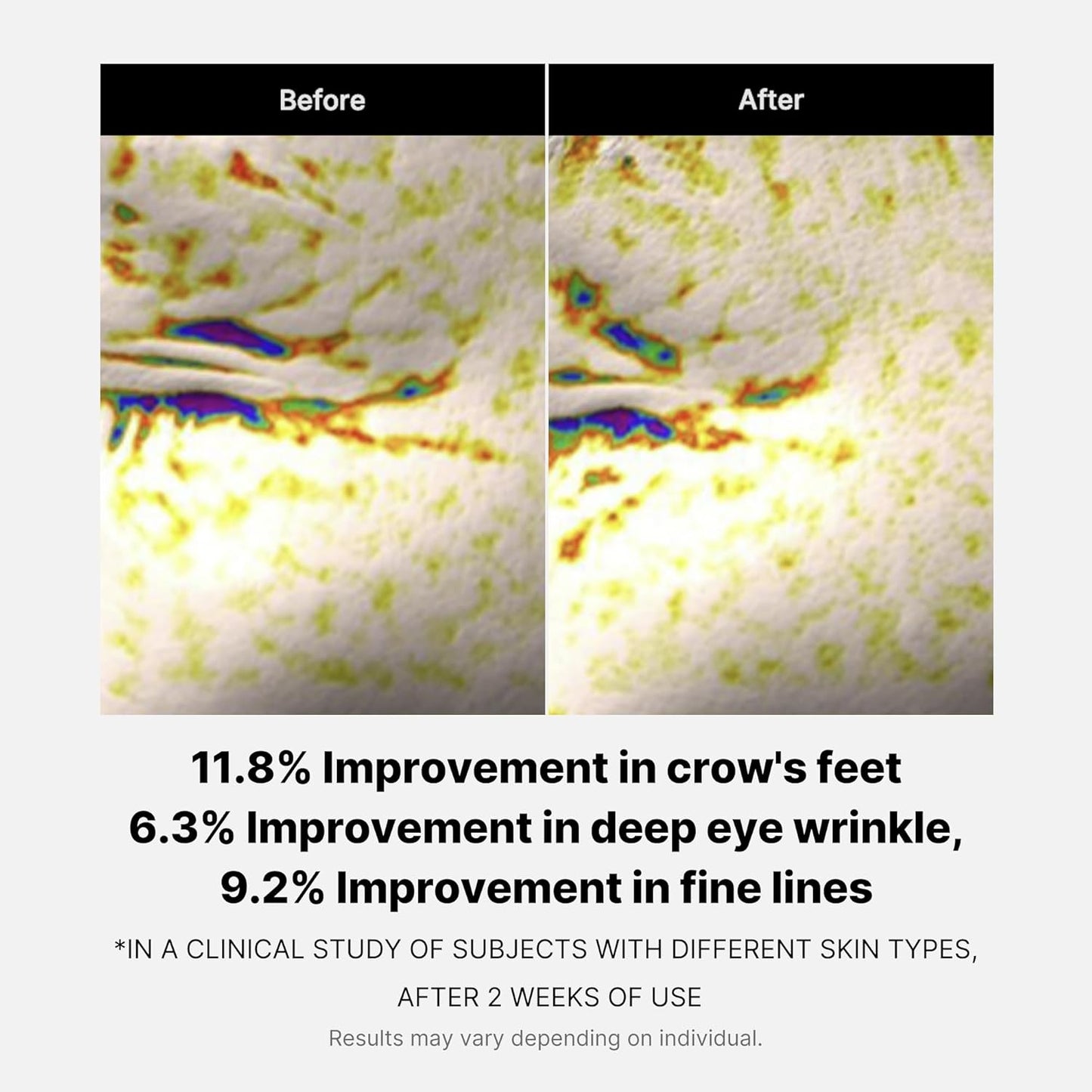 Deep Lifting Peptide Eyecream [30ml]