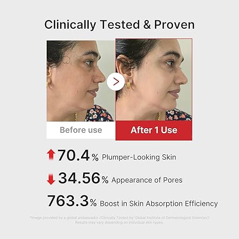 AGE-R Booster Pro [PINK]