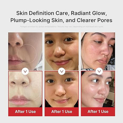 AGE-R Booster Pro [PINK]