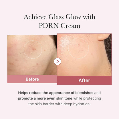 PDRN Pink Hyaluronic  Moisturizing Cream [50ML]