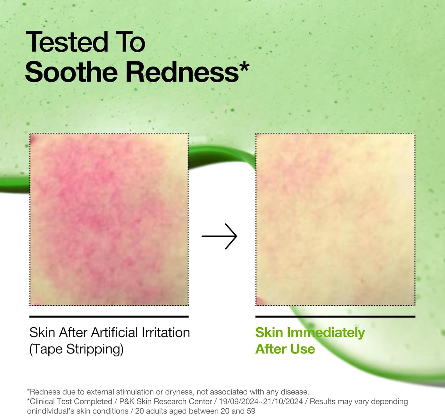 Azelaic Acid 10 Hyaluron Redness Soothing Serum [30ml]