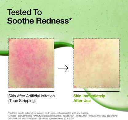 Azelaic Acid 10 Hyaluron Redness Soothing Serum [30ml]