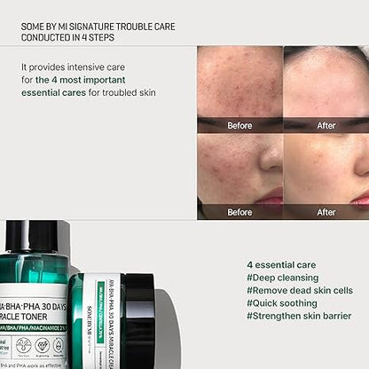 AHA, BHA, PHA 30 Days Miracle Starter Set [4 pcs]