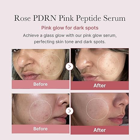 Collagen PDRN Pink Peptide Serum 30ml