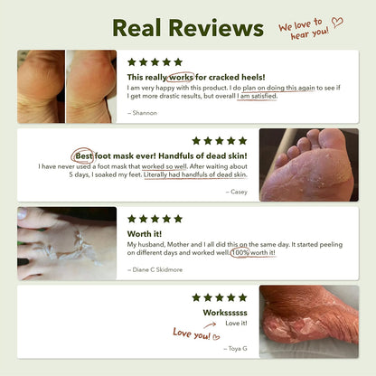 Shiny & Soft Foot Peeling Mask [1 pair]