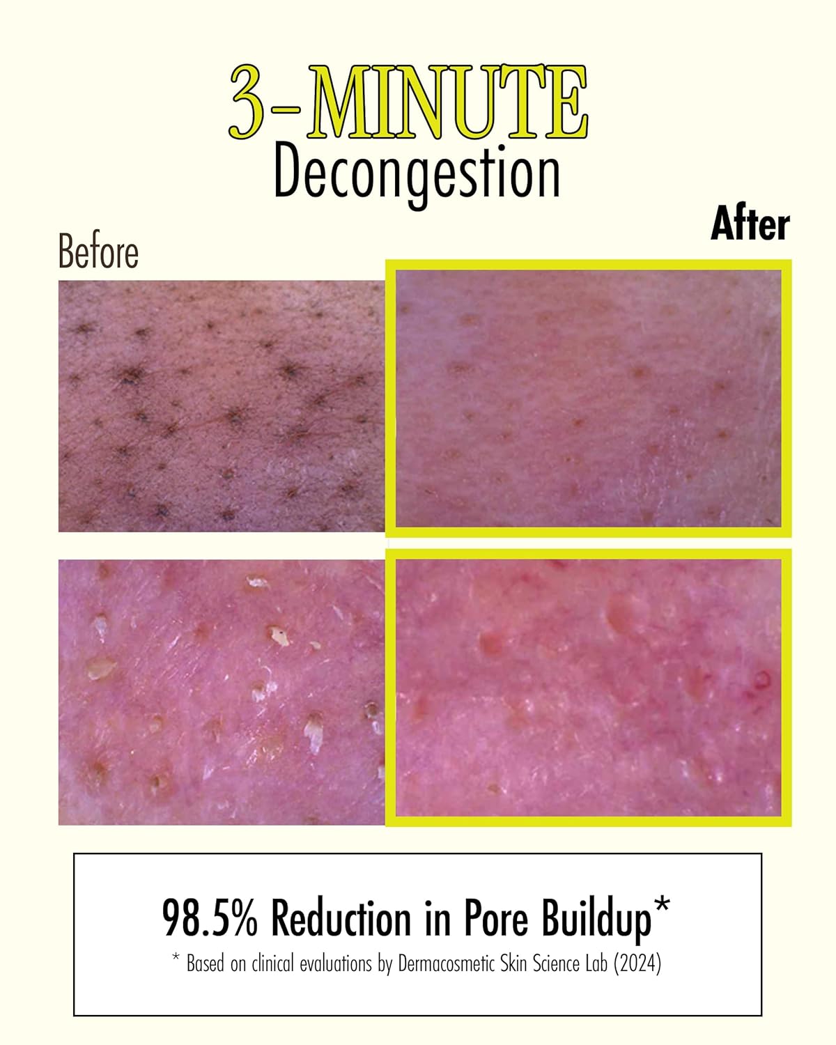 RELIEF MUD STICK MASK [28g]