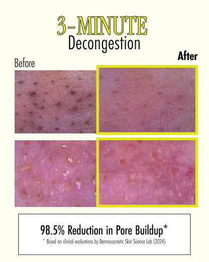 RELIEF MUD STICK MASK [28g]