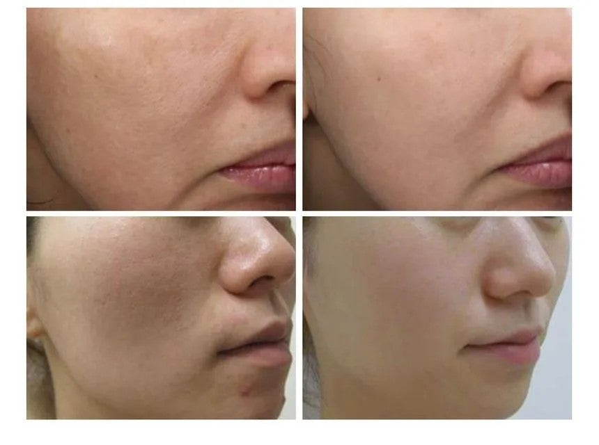 Green Tomato Pore Lifting Ampoule Mask [23g x 1 sheet]