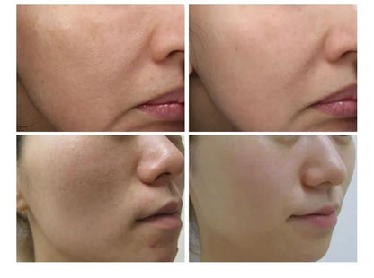 Green Tomato Pore Lifting Ampoule Mask [23g x 1 sheet]