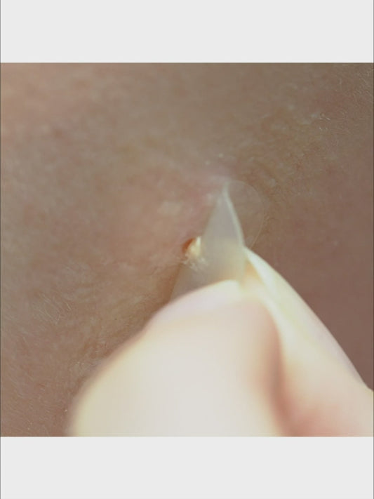 Master Patch Basic [36 patches]