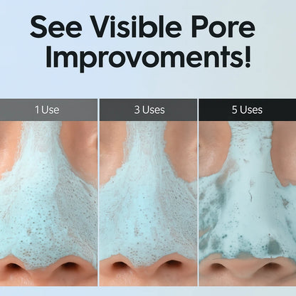 Zero Pore Blackhead Mud Mask [100g]